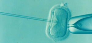 ivf-1514174_1920