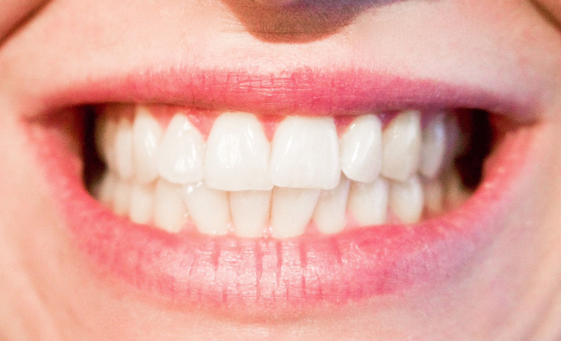 teeth-1652976_1920
